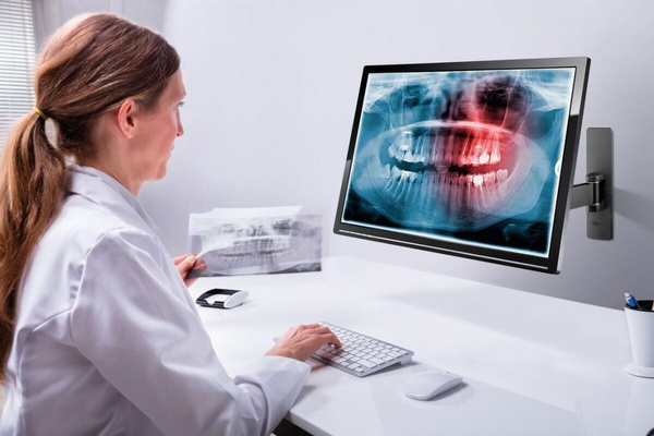 Mbajtëse muri për TV Vogels PFW 1030, 10" 28", e zezë