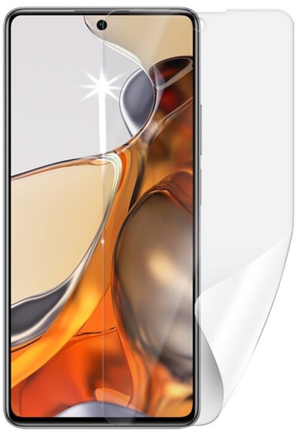 Screenshield	фолија на екранот за Xiaomi 11T Pro