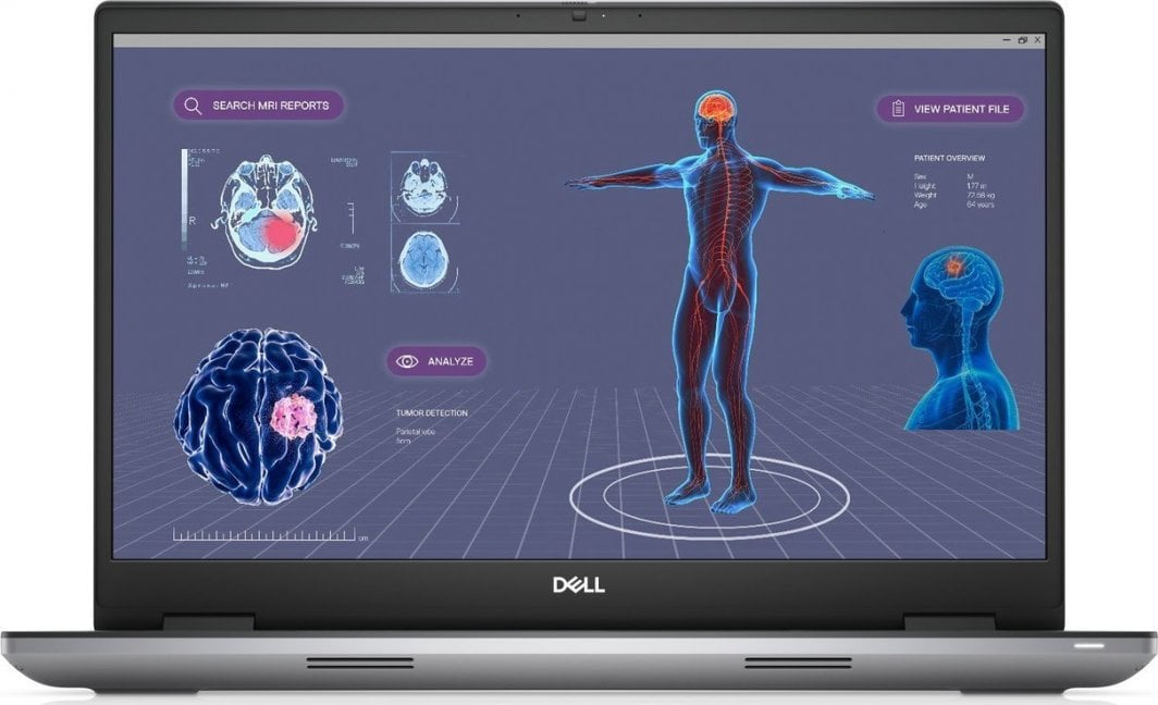 Laptop Dell Precision 7780, 17", Intel Core i7-13850HX, 32GB RAM, 1TB SSD, AMD Radeon Pro W3500, i hirtë