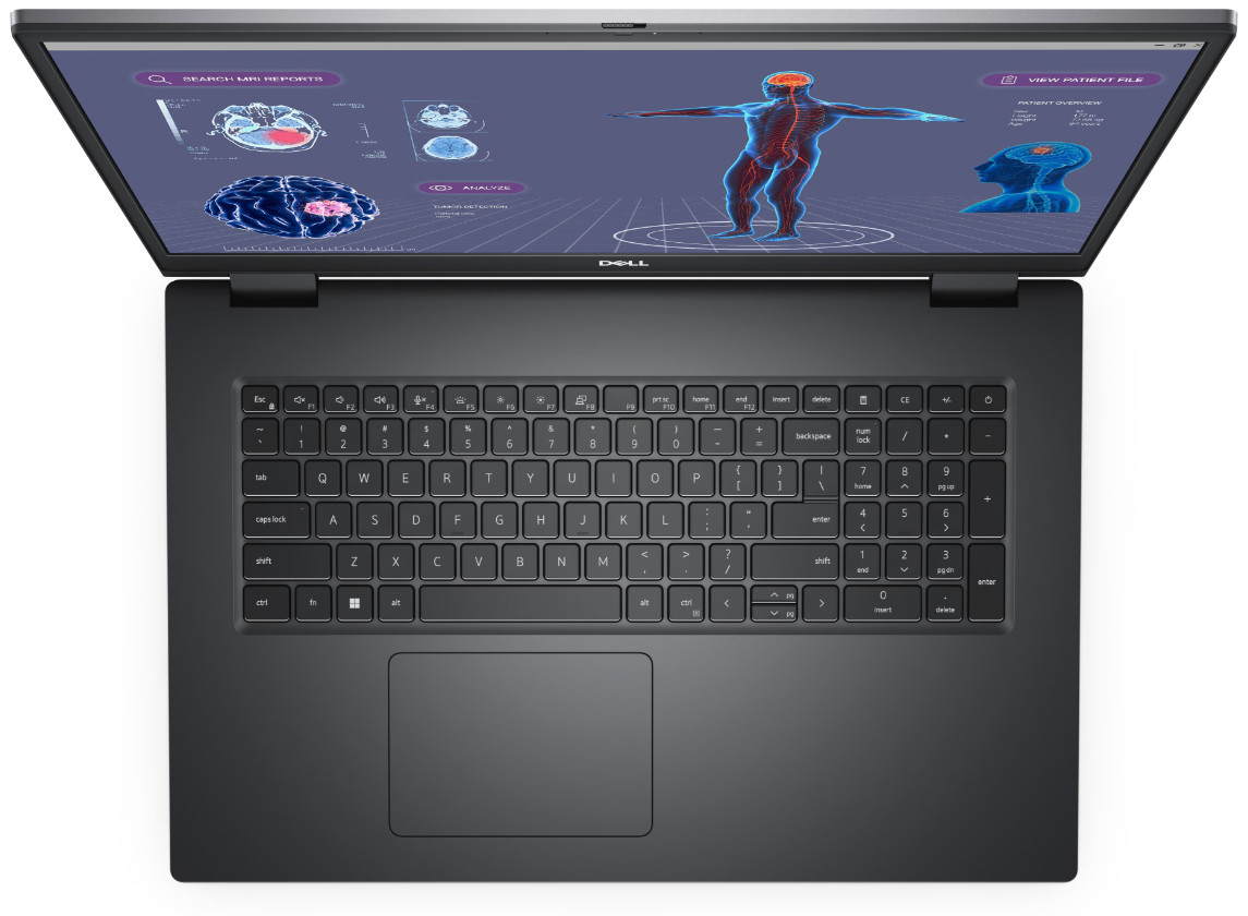 Laptop Dell Precision 7780, 17", Intel Core i7-13850HX, 32GB RAM, 1TB SSD, Nvidia RTX 3500, i hirtë